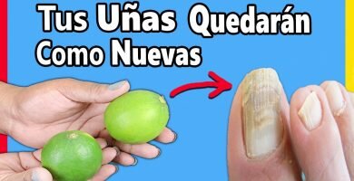 01.2020 hongos