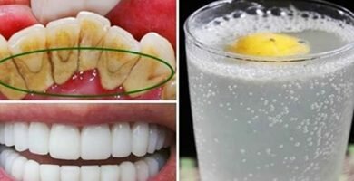 01.2019 dientes
